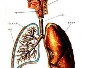 呼吸衰竭
