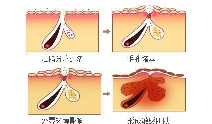 干性皮肤