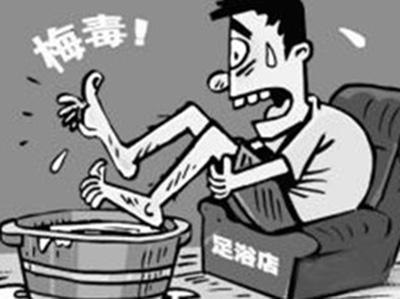 梅毒感染