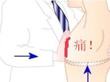 胸骨压痛