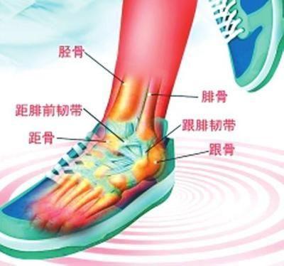 腓肠肌痉挛