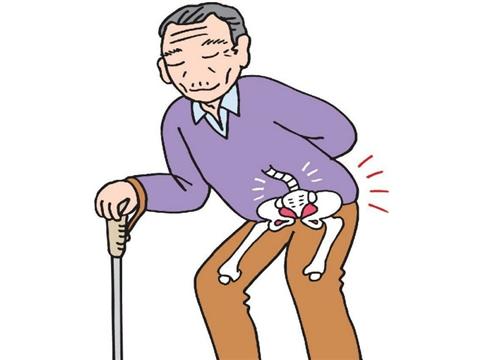 腰椎膨出