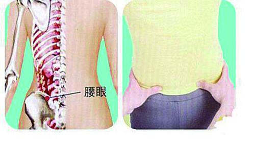 腰肌痉挛