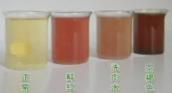 血红蛋白尿
