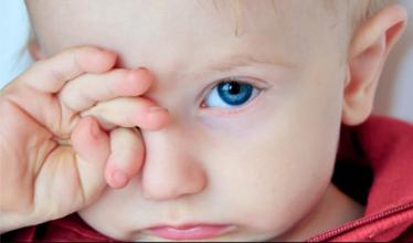 儿童角膜炎的症状图片
