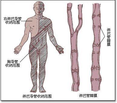下肢淋巴水肿