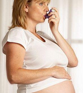 妊娠性哮喘