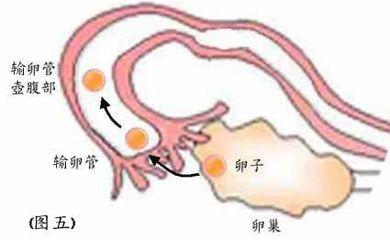 急性输卵管炎