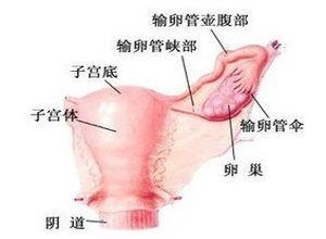 急性输卵管炎