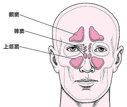 急性额窦炎