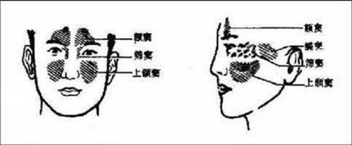 急性额窦炎
