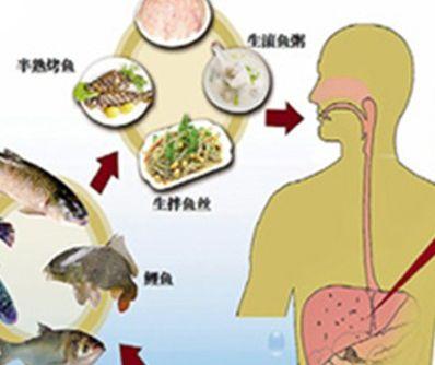 肝吸虫病