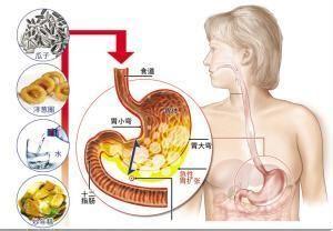 肠系膜裂孔疝
