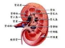 肾性尿崩症