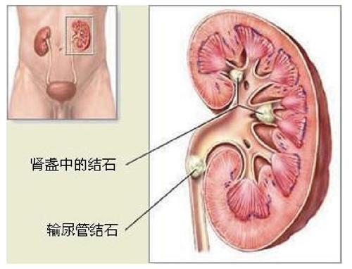 败血症肾损害