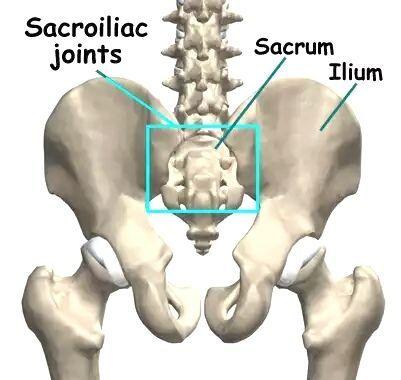 骶髂关节炎