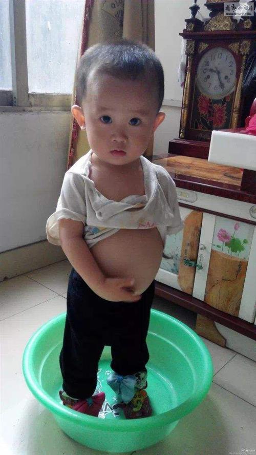 戈谢病
