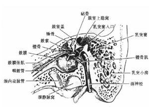 中耳气压伤