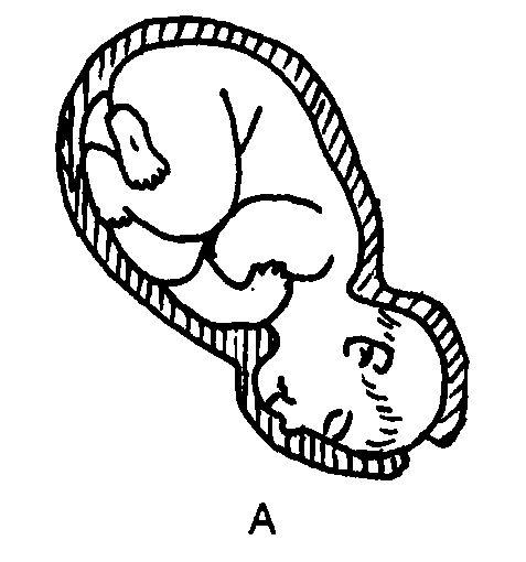 子宫收缩过强