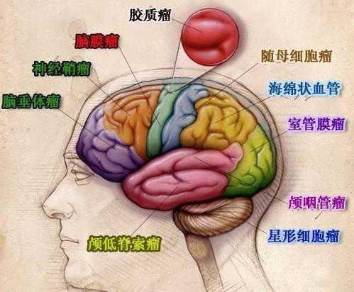 小儿脑干胶质瘤