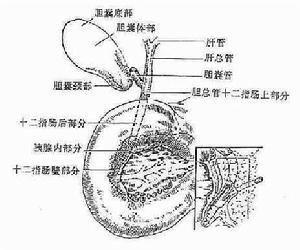 慢性胆管炎