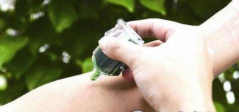 虫咬性皮炎