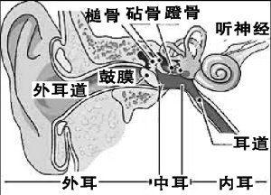 中耳癌