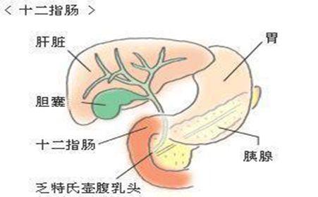 十二指肠憩室