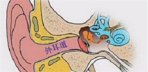 外耳湿疹