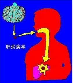 戊型病毒性肝炎
