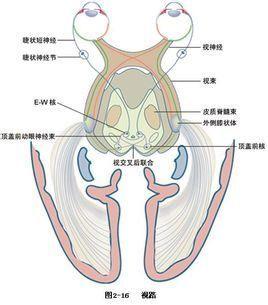 视交叉病变