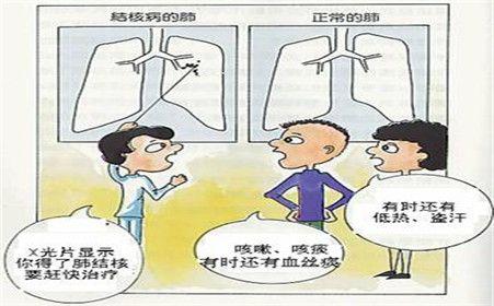 小儿结核病