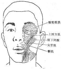 急性泪囊炎
