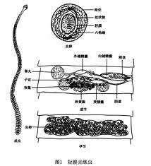 短膜壳绦虫病
