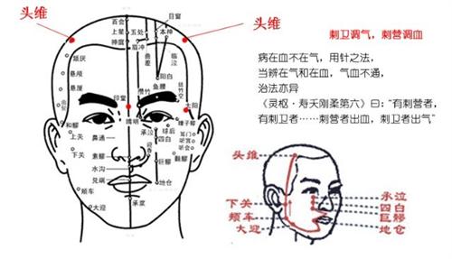 阳明头痛