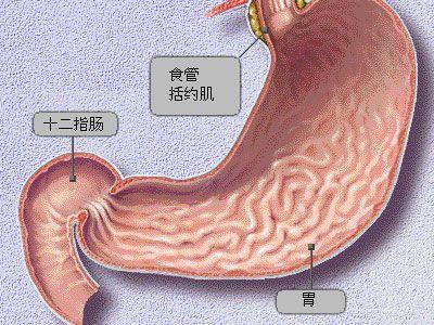 胆汁返流性胃炎