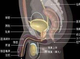 前列腺异位