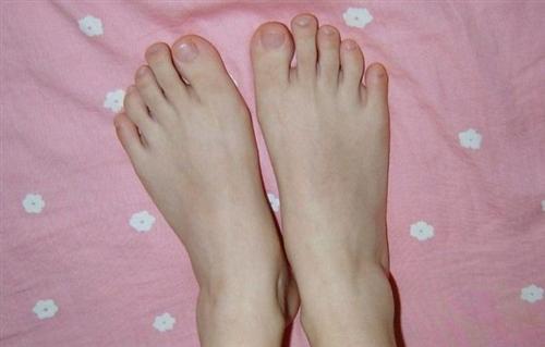 水疱型脚气