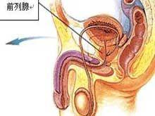 前列腺脓肿