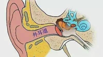 外耳道乳头状瘤