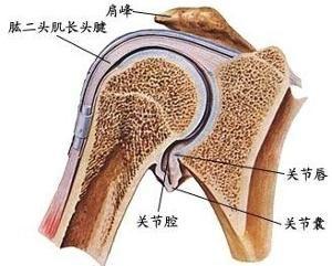 感染性关节炎