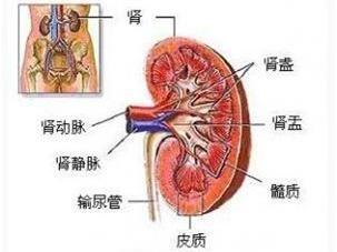 肾盂癌