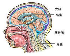 脑脊液漏