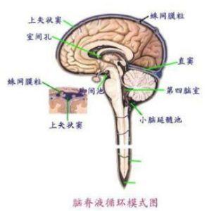 脑脊液漏