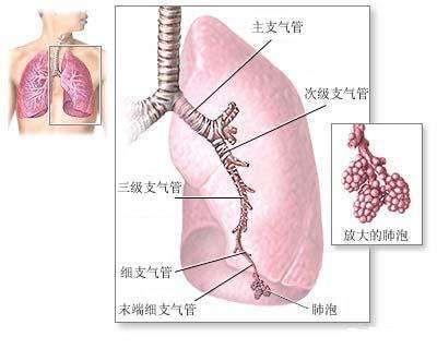 先天性肺发育不全