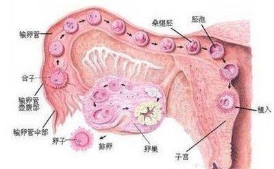 卵巢肿瘤破裂