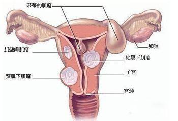 滴虫性外阴炎