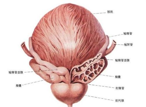 膀胱腺癌