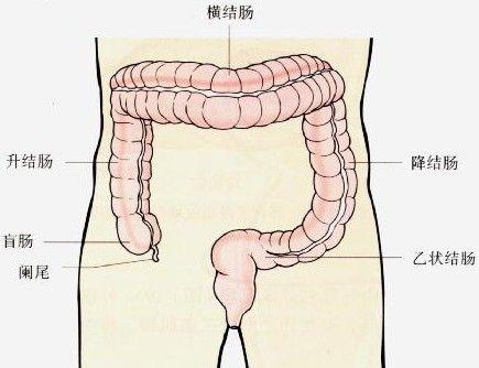 慢性溃疡性结肠炎