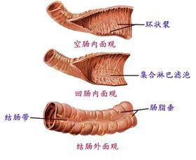 慢性溃疡性结肠炎
